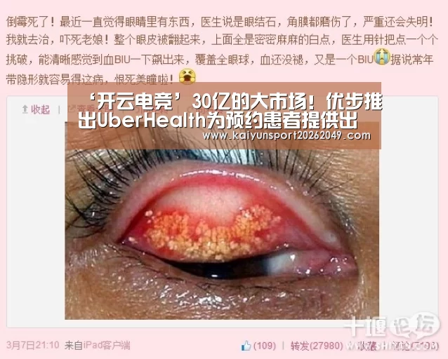 ‘开云电竞’30亿的大市场!优步推出UberHealth为预约患者提供出行服务(图1) 开云视讯